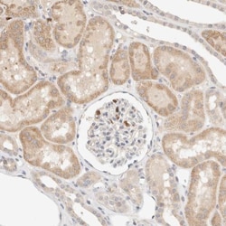 TTC3 Antibody, Novus Biologicals 0.1mL; Unlabeled:Antibodies, Polyclonal